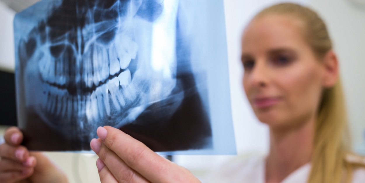 Kiedy zdecydować się na zabieg augmentacji kości?