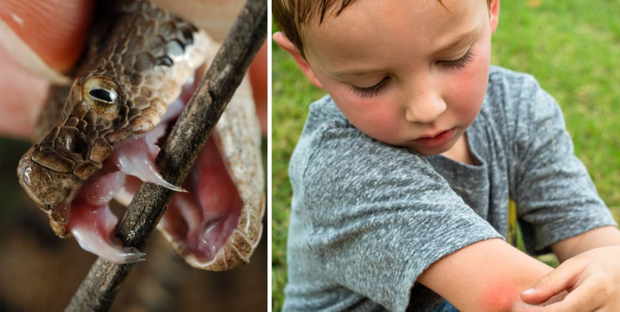 Dwukrotny ATAK żmii zygzakowatej. Ucierpiały DZIECI