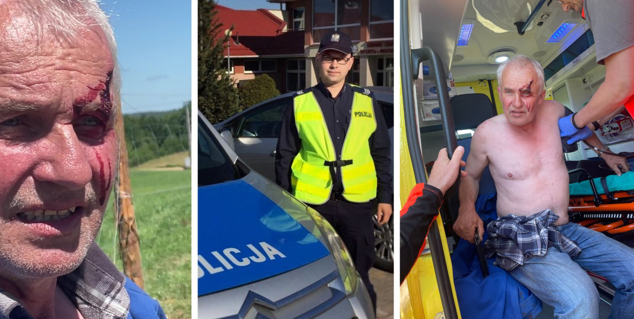 Józef Lange twierdzi, że pobił go przewodniczący Rady - policjant