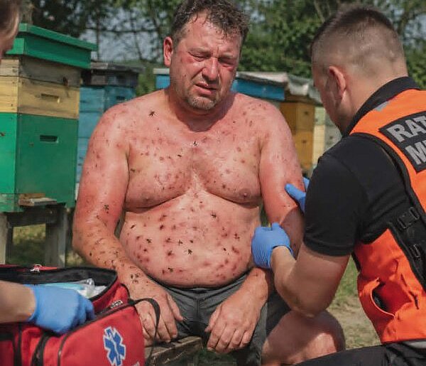 Pszczoły zaatakowały 38-latka. Na karetkę czekał kilkadziesiąt minut
